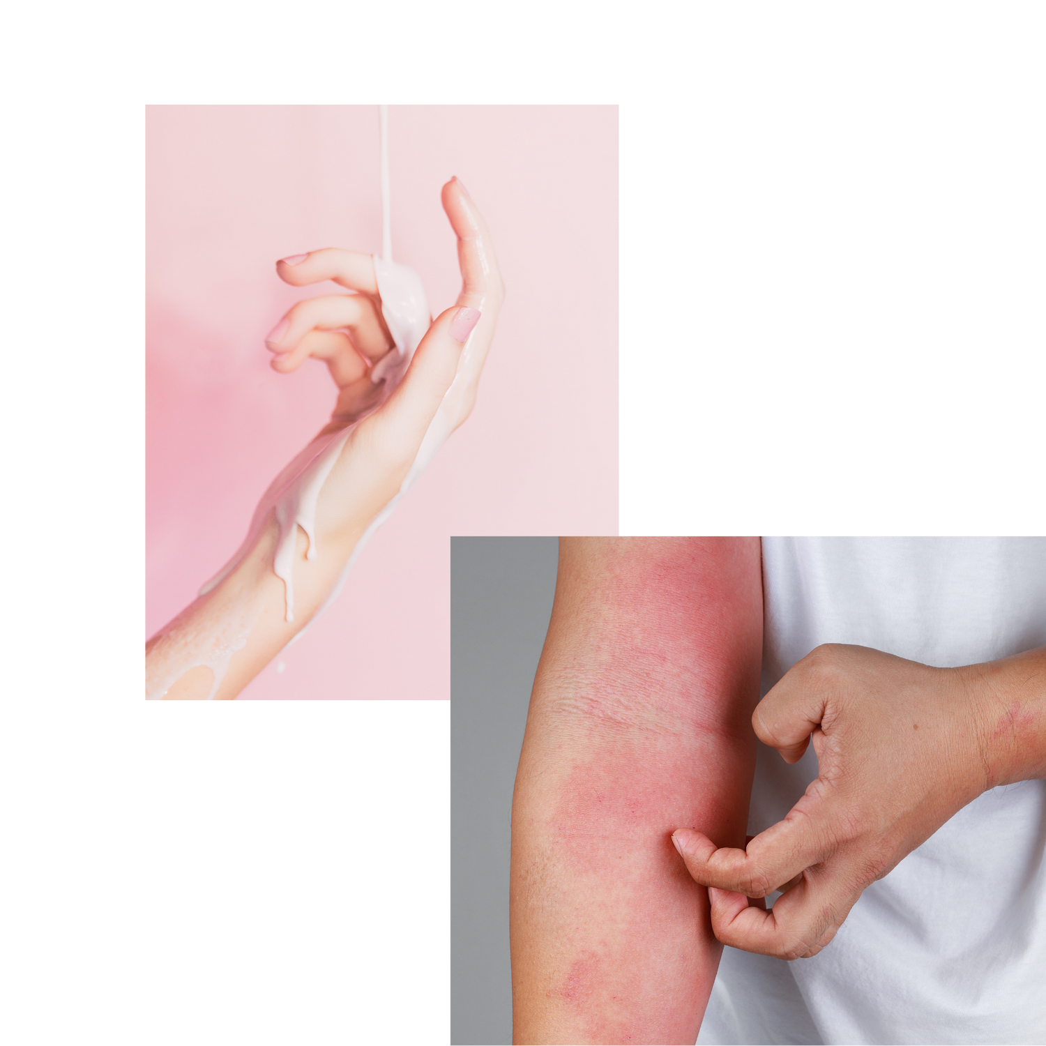 A collage of images: the first is of a hand on a pink background, a liquid product is being poured over the hand. The next picture is of an allergic reaction on a arm.